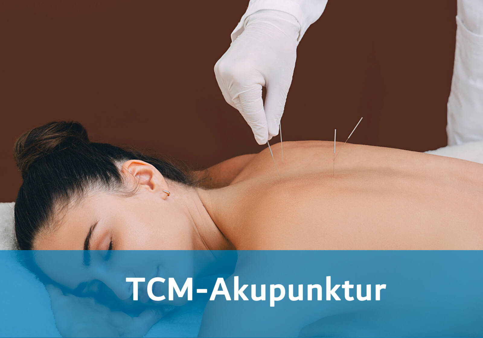 Erleben Sie die harmonisierende Wirkung der TCM-Akupunktur in unserer Praxis für ganzheitliche Gesundheit ✅ Jetzt buchen nahe Basel | Thera Torso