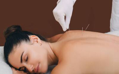 Neues Therapieangebot bei Thera-Torso: TCM-Akupunktur (Traditionelle Chinesische Akupunktur)